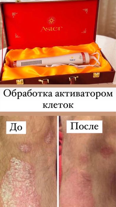 Активатор клеток