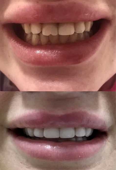 CAD/CAM услуги по низкой цене зуботехническая лаборатория