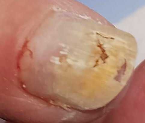 Podologica Pedichiura complexa