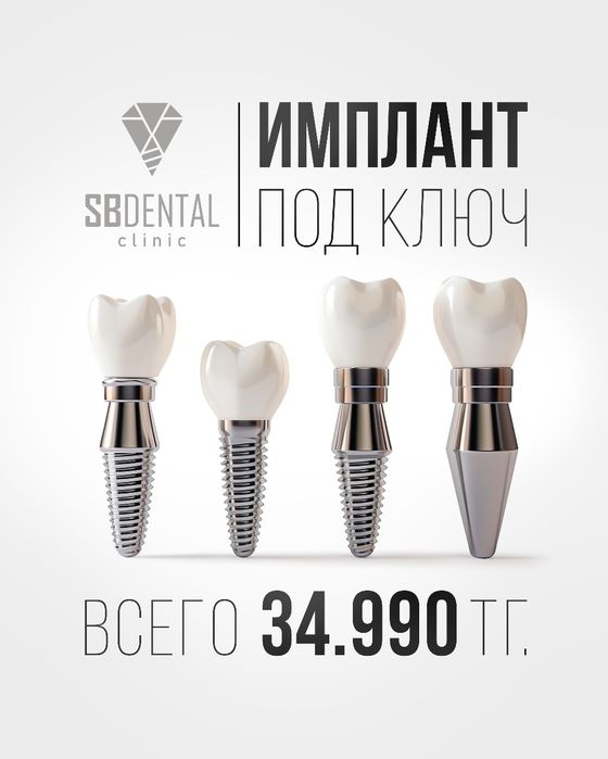 Стоматология  Имплантация