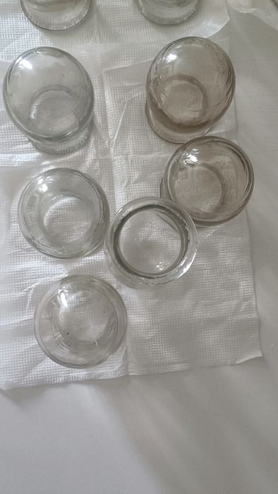 Банки для спины.