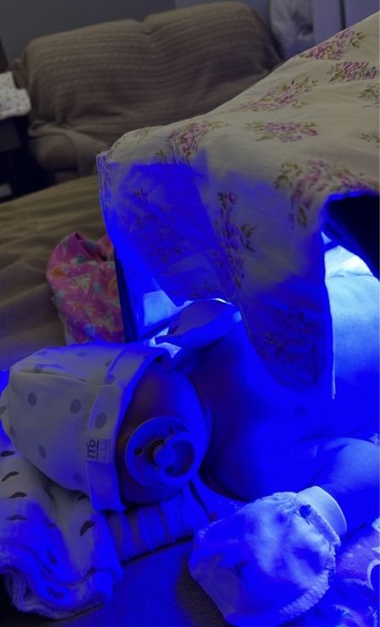 Фотолампа от желтушки