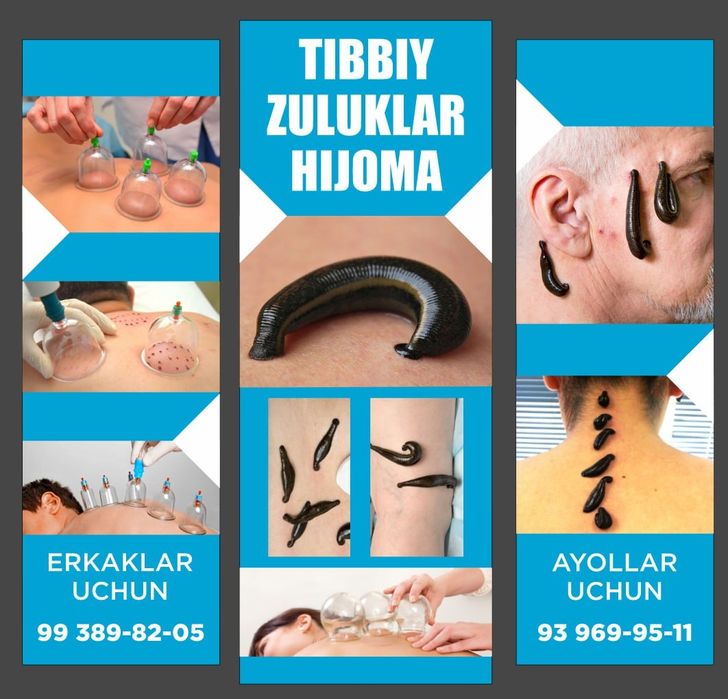 тиббий зулуклар гирудотерапия