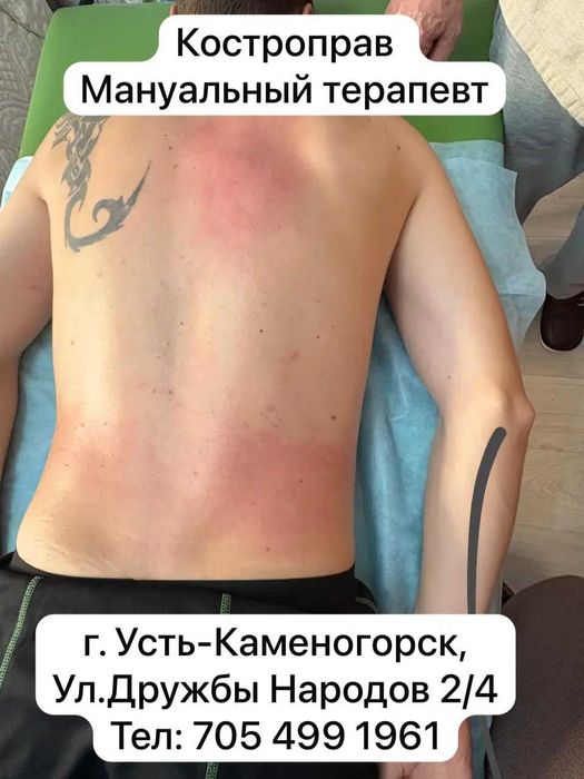 Мануальная терапия (костоправство)