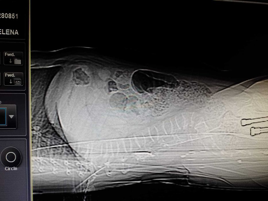 Masaj Kinetoterapie Recuperare  medicala Caracal Slatina Craiova