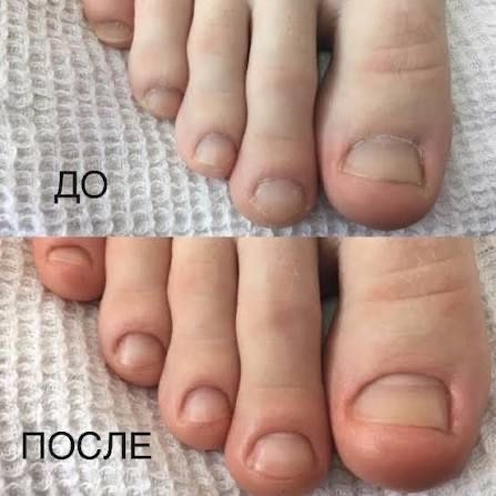 Маникюр и педикюр с выездом на дом