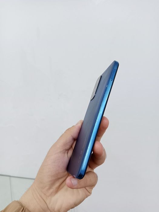 Redmi Not11 xolati yaxshi