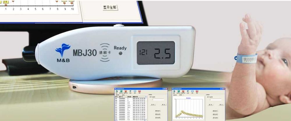 Bilirubin MBJ 20/30 – Aппарат для измерения билирубина (гарантия)