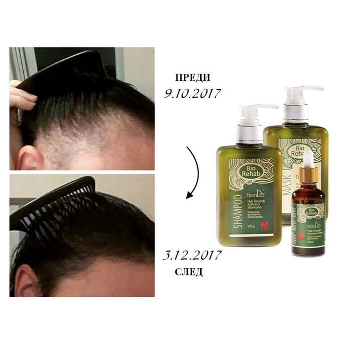 Комплект Bio Rehab против косопад