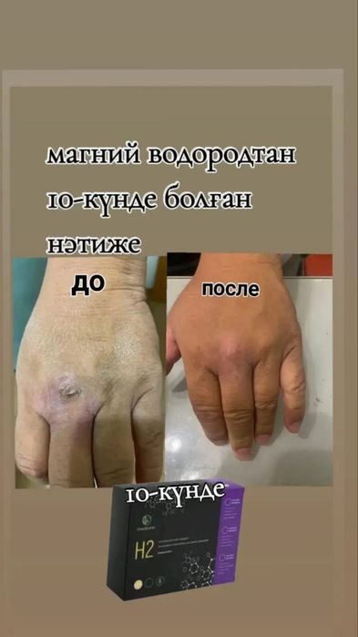 Продам магний водород