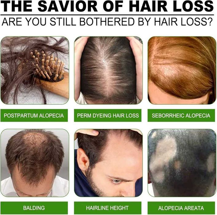 ПРОМО ЦЕНА! Серум против косопад, 20мл