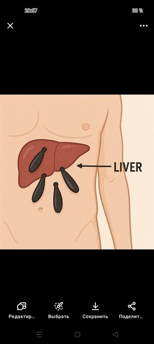 зулук пиявки гирудотерапия