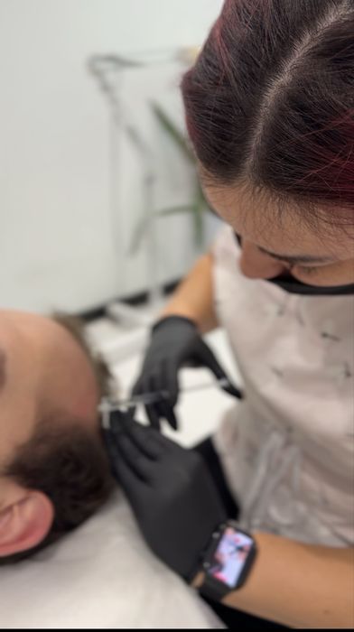 Мезотерапия для волос у мужчин | Залысины | Выпадение