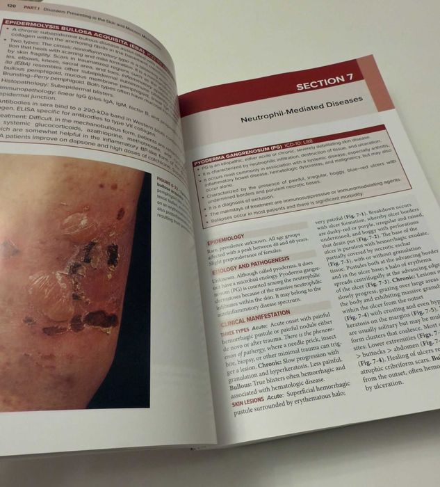 Fitzpatrick's Color Atlas and Synopsis of Clinical Dermatology NOU !