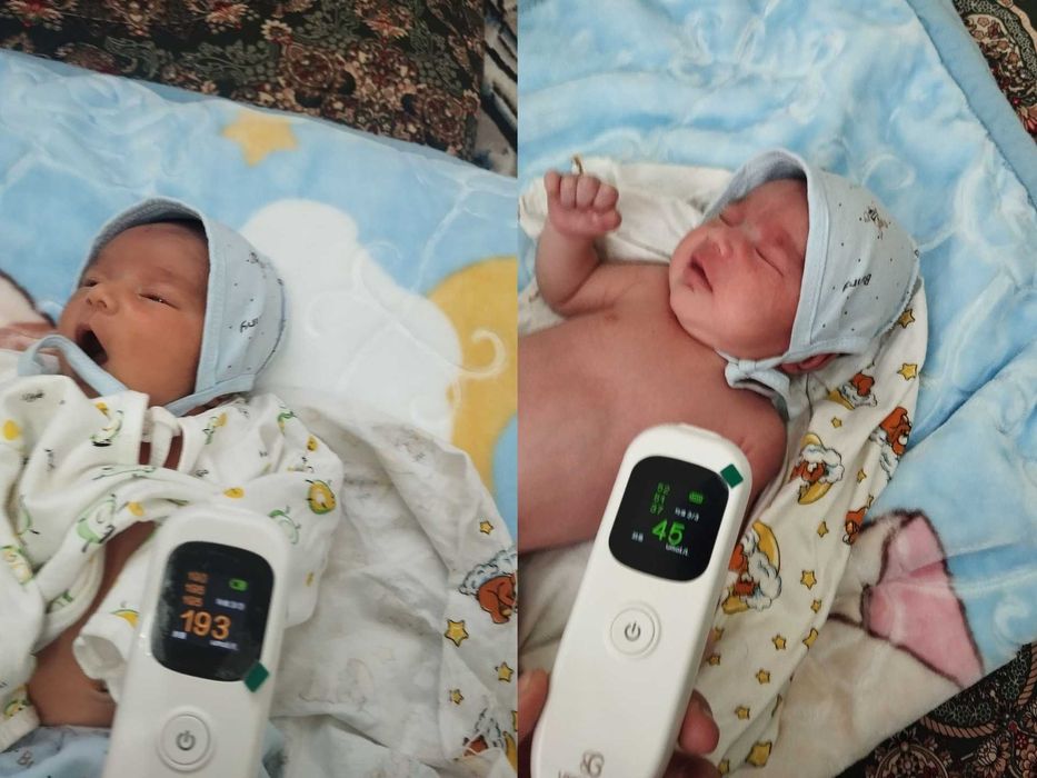 Фотолампа,Продаю Фотолампа от желтухи у детей Есть доставка по городу.