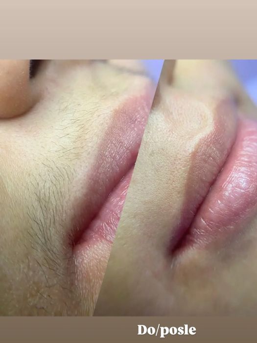 Depilatsiya faqat ayyollar qizlar uchun