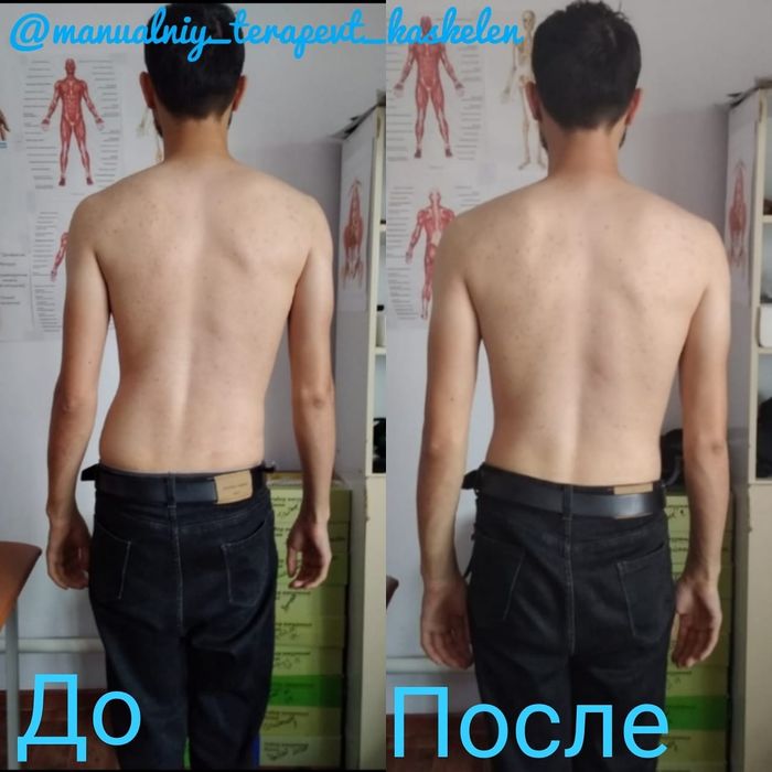 Хиджама/Массаж на выезд