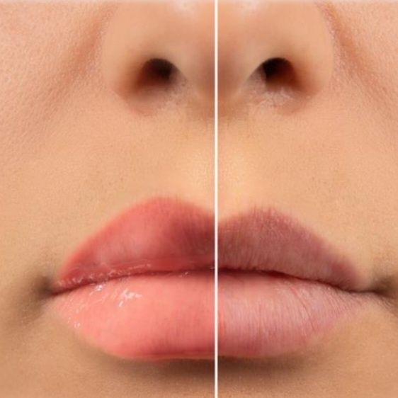 Ofertă Farmasi‼️Lip plumper nuanțator, nou