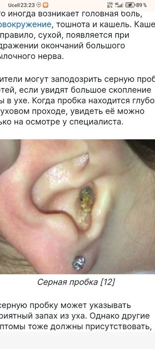 Фито свеча ушная