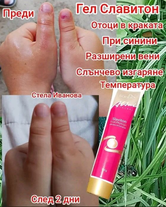 Фитогел за крака