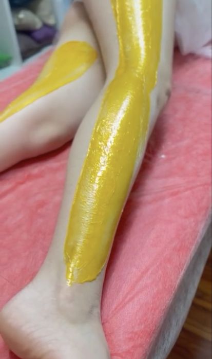 Эластомерная депиляция