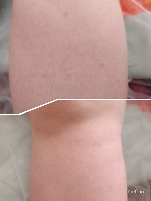 Женский шугаринг с выездом