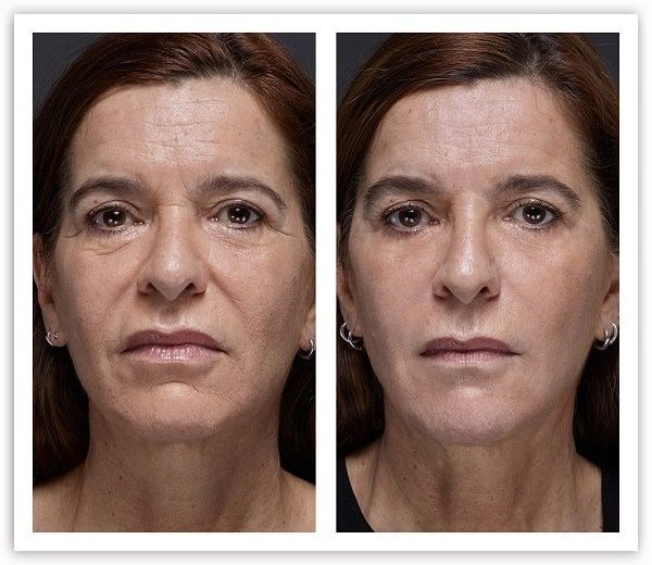 Косметолог стаж 30 лет