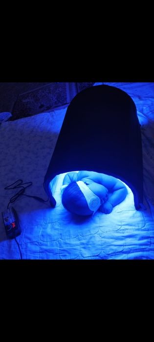 Фотолампа от желтухи