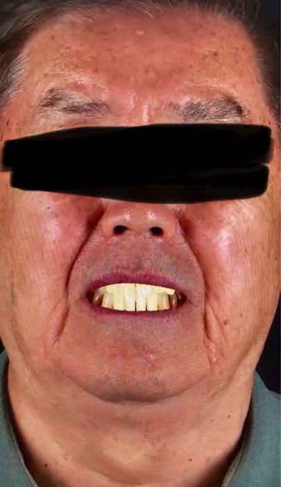 Импланты от 49.999.