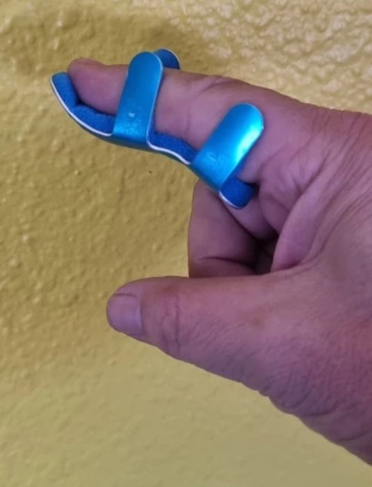 Лонгета на палец при переломах