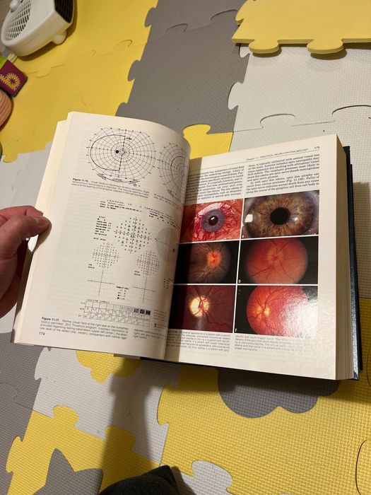 Неврохирургия на Тиндал 3 тома. Practice of Neurosurgery Tindall