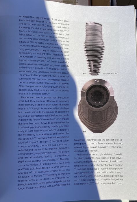 The Single-Tooth Implant J.Chu