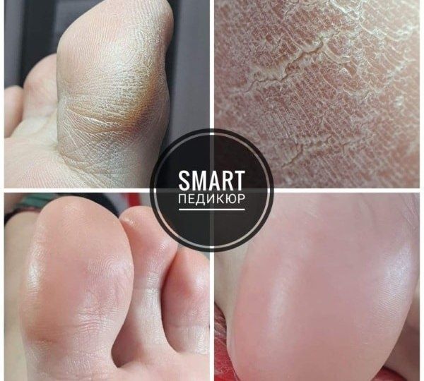 Курсы " Супер Smart педикюр"- 45.000 тг