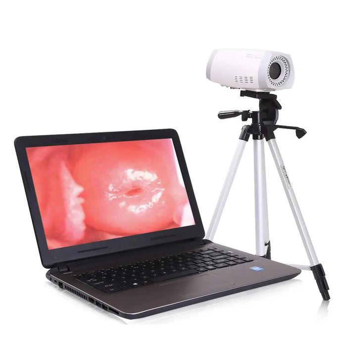 Кольпоскоп SONY CCD Color video camera