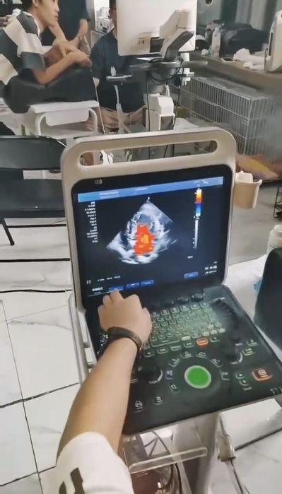 Портативный Узи 9.600$