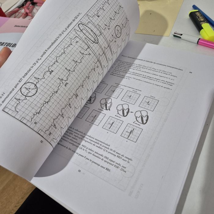 Ecg in 10 zile (copie)
