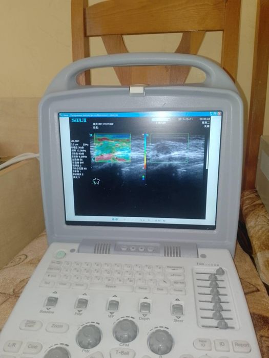 Мобилен ехограф.