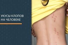 Скидка 10% Дезенфекция дизенфекция дезинфекция дизинфекция dizinfeksiy