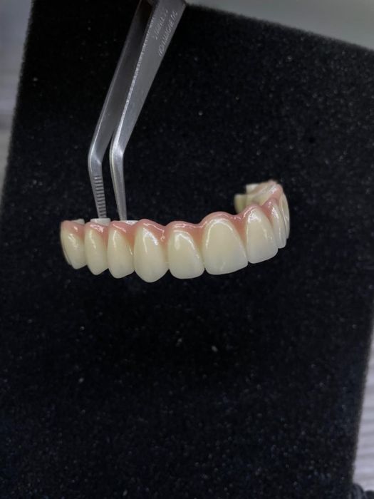 Тіс Протезирование