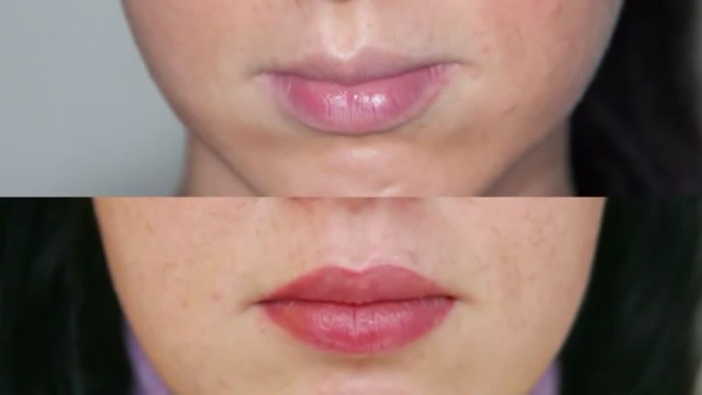 Косметолог,ботокс