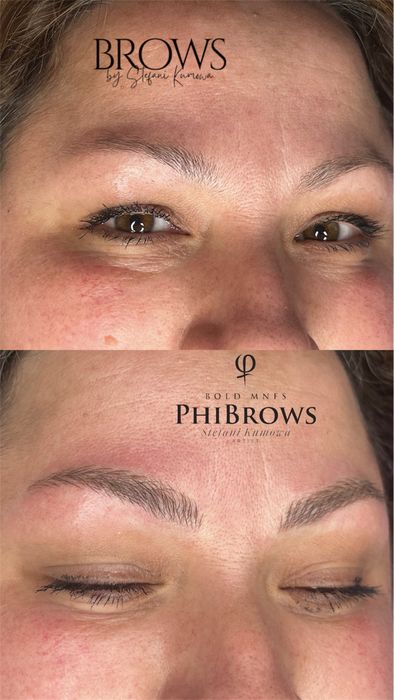 Процедура Микроблейдинг