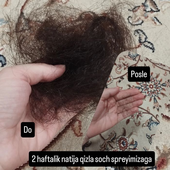 Soch tokilishini to'xtatadi va yengi sochlar juda tezlikda chiqadi