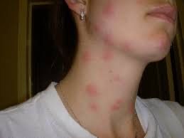 Дезенфекция дизенфекция дезинфекция дизинфекция dizinfeksiya