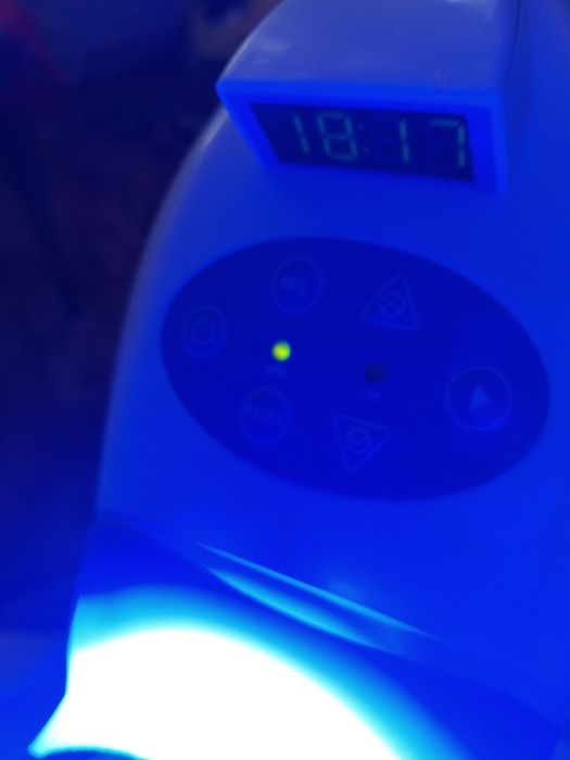 Отбеливание зубов профессиональными гелями