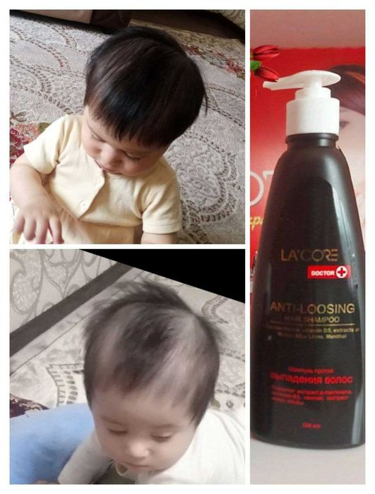 Soch ostiruvchi Shanpoon