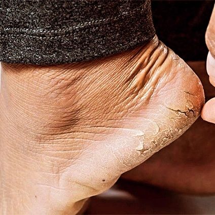 Только для мужчин!!!