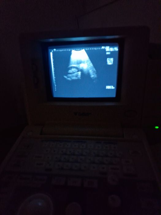 Ecograf portabil Fukuda Denshi FF Sonic UF-4100 – 2 sonde