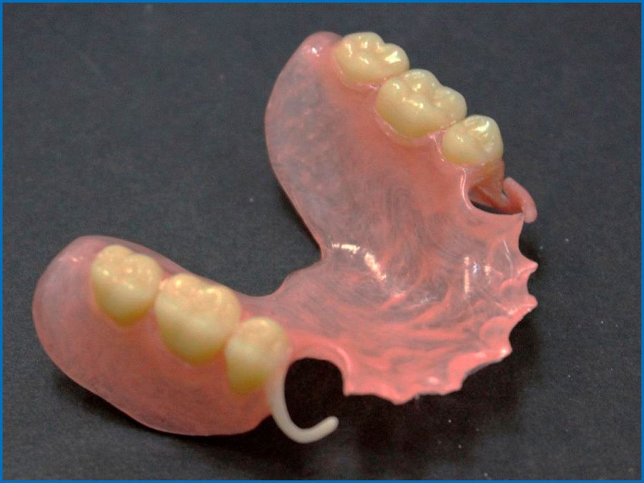 Изготовление сьемных протезов