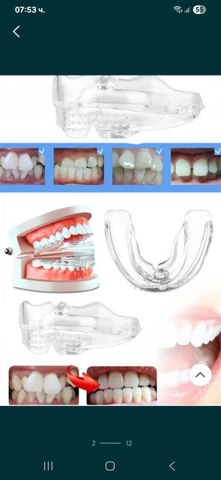 Ортодонтски коректор,шини,алайнер на зъби брекети зъбен фиксатор
Невид