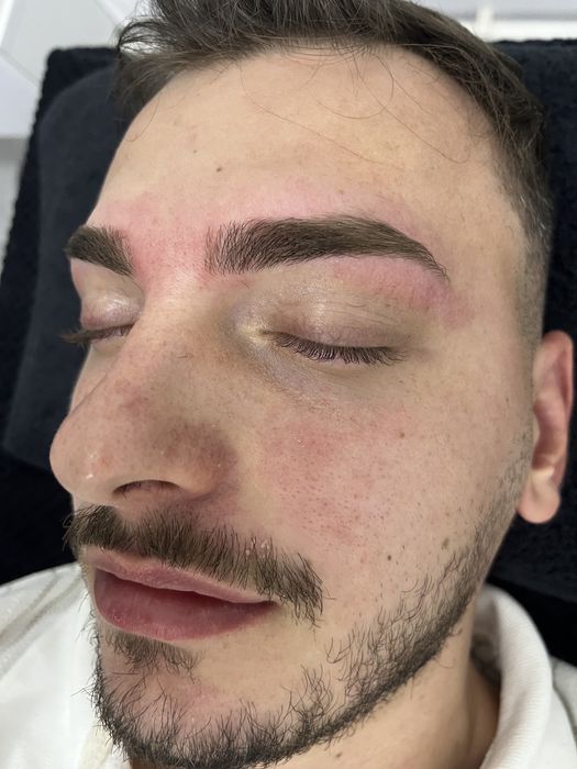 Epilat cu ceara de unica folosinta/Pensat